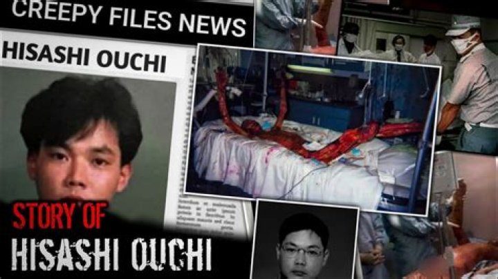 83 Days Of Hisashi Ouchi's Suffering Revealed