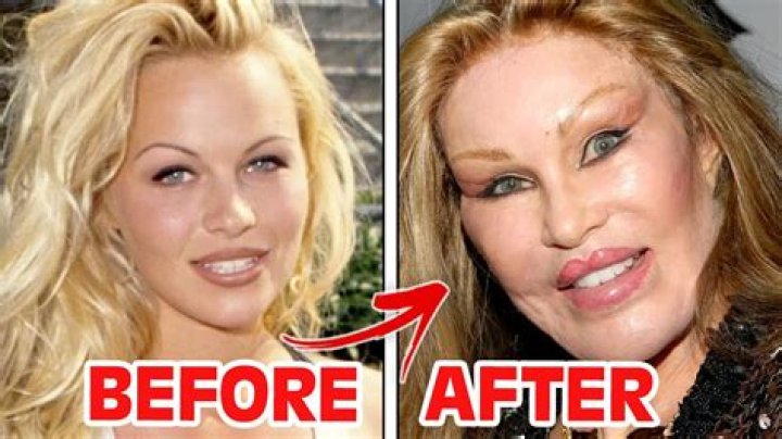 90 Day Fiance star Natalies before and after plastic surgery pictures explored Mon 28 J |