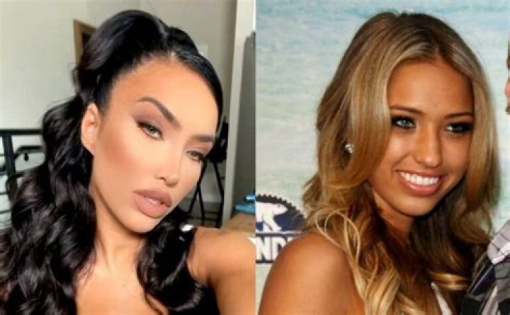 Did She Underwent Surgery? |