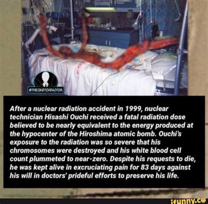 Hisashi Ouchi's Radiation Exposure And Its Impact On Nuclear Safety