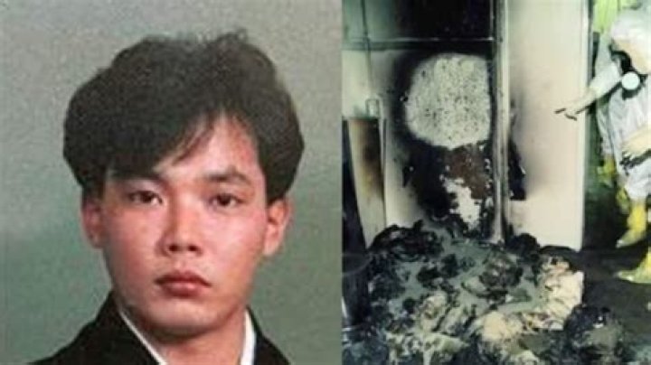Hisashi Ouchi Pictures In Hospital