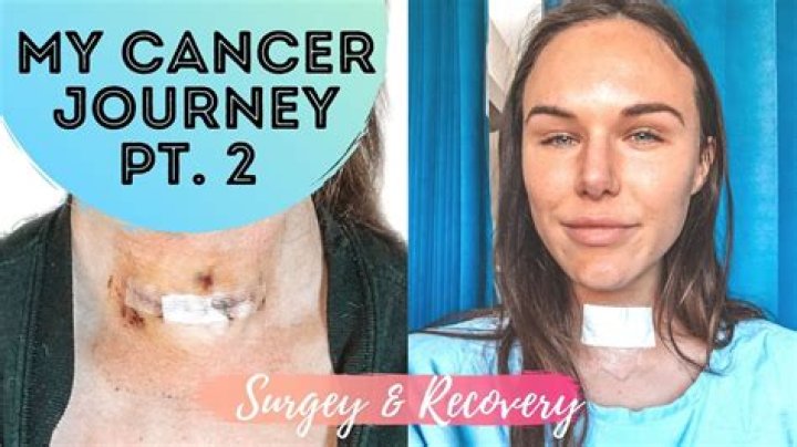 Joyce Vance's Thyroid Cancer Journey
